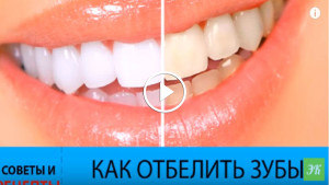 6 способов отбелить зубы в домашних условиях