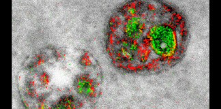 первые цветные изображения, сделанные с помощью электронного микроскопа