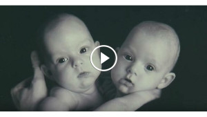 Чтобы разделить этих близняшек, медики трудились 12 часов. Вот какими стали малышки через 10 лет…